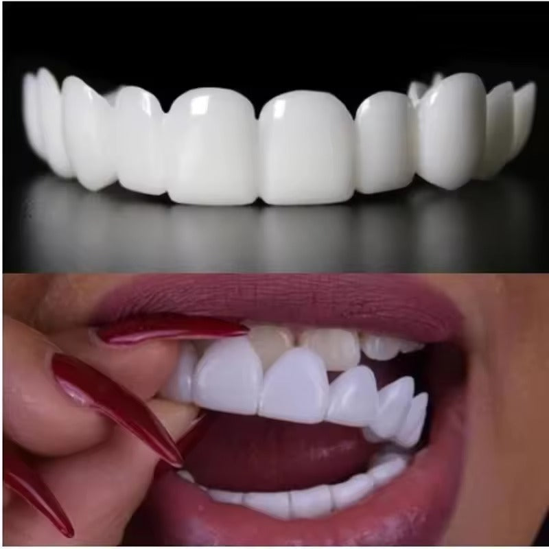SnapBright™ Snap-On Veneers